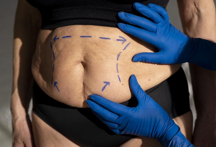 Condena por procedimiento estético que terminó con muerte de paciente