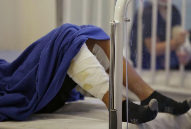 Quemados con pólvora