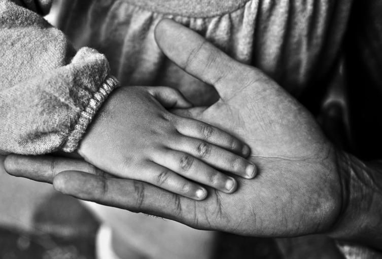 Padre acusa que cuidadora quemó a su hijo con un secador: caso sigue sin avances