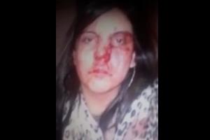 Mujer golpeada por su expareja, en Bogotá.