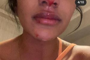 Daniela Cortés, maltratada por Sebastián Villa