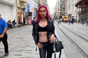 La mujer con las mejillas más grandes del mundo