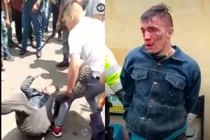 Ladrón en Alquería sufrió paliza colectiva y hasta casi le sacan un ojo