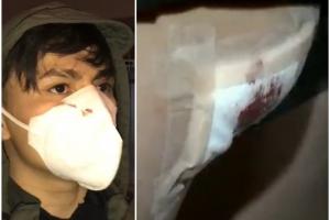 Nicolás Sánchez denuncia que fue agredido por Policía 