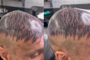 Calvo desesperado decidió tatuarse pelo para verse mejor ¿Le luce?