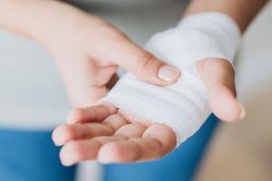 Mujer quemada con bebida caliente