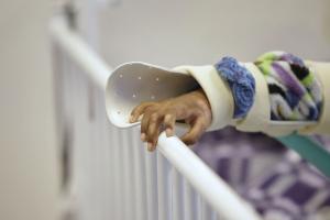 Quemados con pólvora