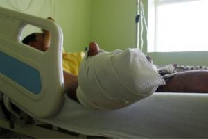 Quemados por uso de pólvora