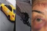 Taxista agrede a pasajera 
