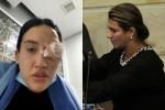 “Dejen de llorar por un solo ojo”: senadora Paola Holguín hace comentario paila