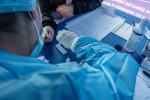 Más de 2.000 casos de hepatitis en Bogotá entre 2021 y 2025