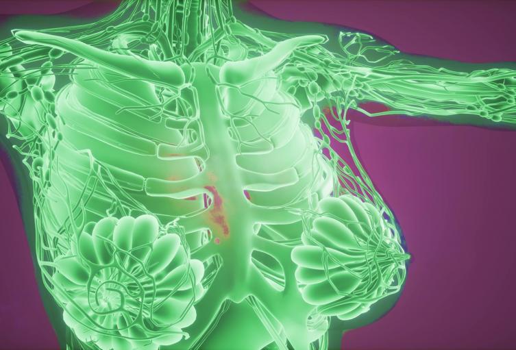 Tecnología detectaría cáncer de seno