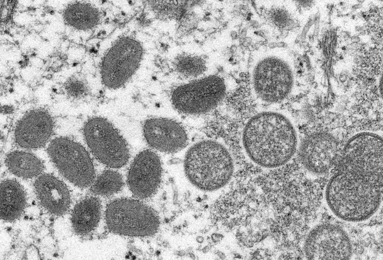 Virus de la viruela del mono
