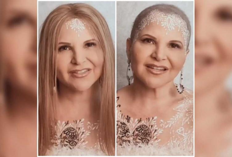 Diva Jessurum con cáncer