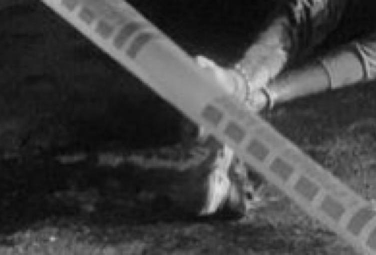 Referencia de inspección técnica al cadáver 