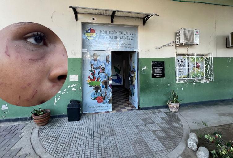 Víctima de Bullying 