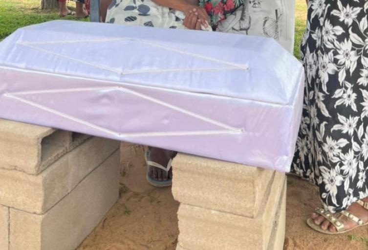 Desnutrición en La Guajira. 