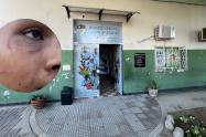 Víctima de Bullying 