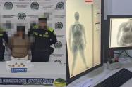 Capturan a mujer en el aeropuerto de Cartagena con cocaína oculta en su estómago 