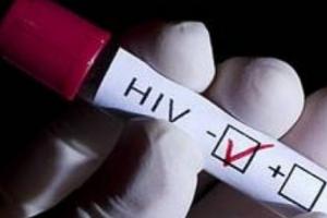 La actividad está asociada a la ruleta rusa sexual, práctica que consiste en tener relaciones sexuales aplicándose sustancias antirretrovirales