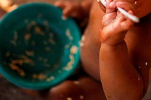 Menores con desnutrición en Atlántico. 