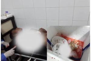 Le cercenaron una mano