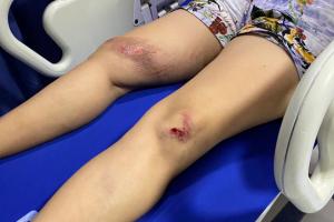 Mujer atemorizada en Cartagena
