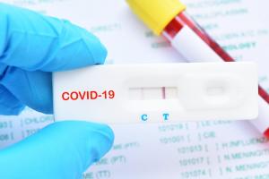 Pruebas caseras de Covid 19
