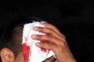 Tres de los capturados resultaron con lesiones por arma de fuego