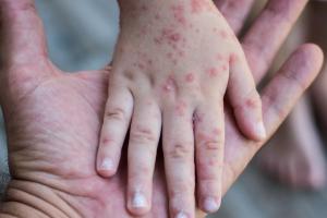 Fotografía no relacionada directamente con los hechos 