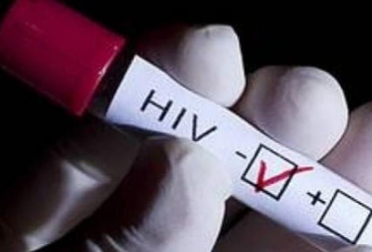 La actividad está asociada a la ruleta rusa sexual, práctica que consiste en tener relaciones sexuales aplicándose sustancias antirretrovirales