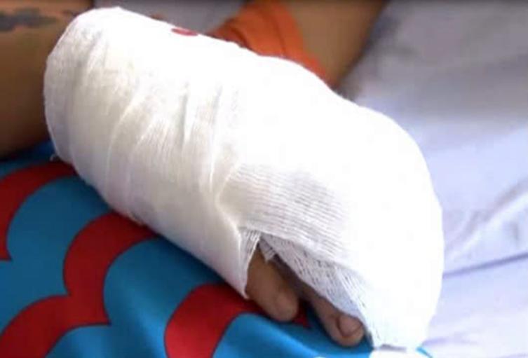 Quemados en Antioquia 