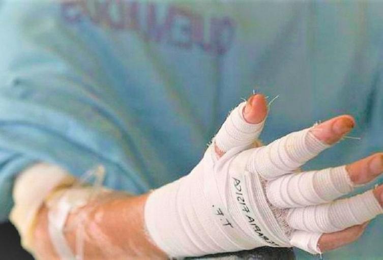 A 95 aumentó la cifra de personas quemadas con pólvora en Antioquia 