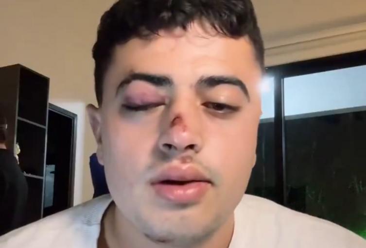 Joven denunció que fue drogado y robado en Medellín 
