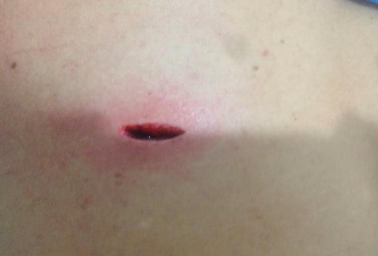 La apuñalaron tres veces durante la rumba, salió al hospital y murió en su casa en Bello