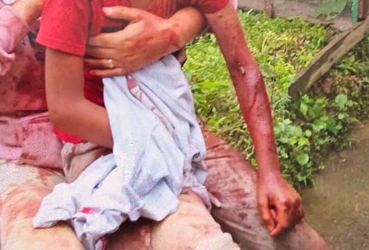 Ninos - Atacados -Antioquia 2025