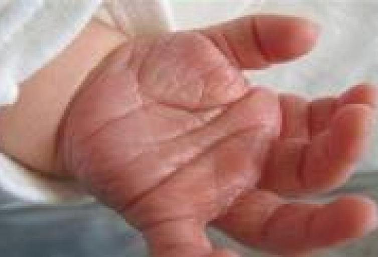 Referencia de un bebé en Antioquia 