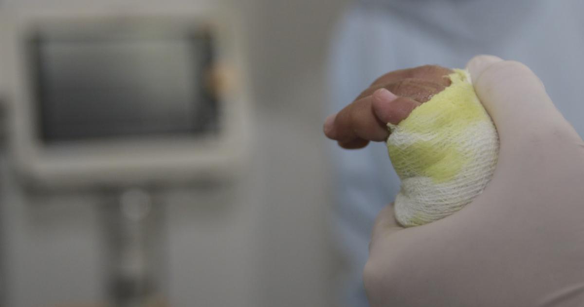 Pólvora en Medellín: 27 quemados en tan solo nueve días de diciembre