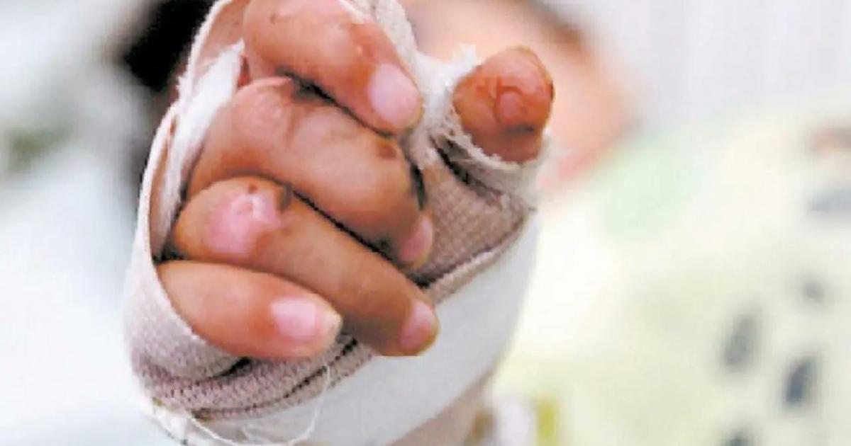 Triste noche de velitas en Antioquia: nueve lesionados con pólvora