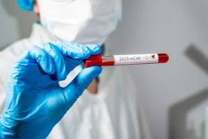 Ya resultó el primer alcalde de Colombia contagiado con coronavirus