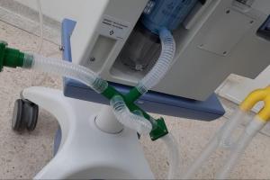 Se quiere aumentar la capacidad de personas conectadas a ventiladores usados en pacientes con Coronavirus 