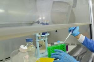 Confirmados nuevos casos de Coronavirus en Colombia