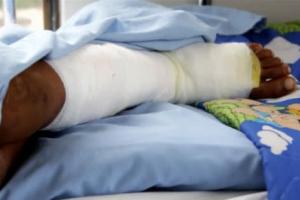 Mujer quemó vivo a su esposo porque hablaba con otras mujeres 