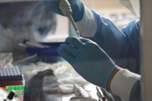 EPS entrega resultados de coronavirus tarde