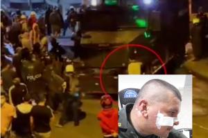 Una bomba molotov le quemó el rostro a un policía en Caldas, Antioquia
