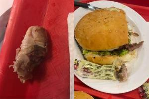 Mujer comía hamburguesa y le salió un dedo humano al cuarto mordisco