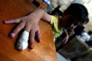 Un niño de cinco años está entre los lesionados recientes.
