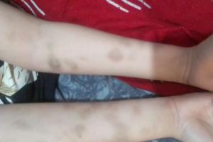 Menor víctima de bullying en Bucaramanga 