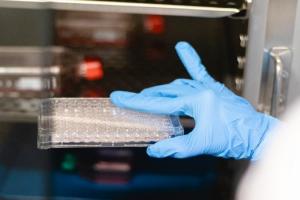 En laboratorio en Medellín lograron aislar el virus de la viruela del mono 