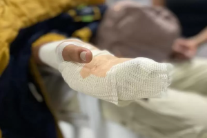 Ya son 36 los lesionados por pólvora en Antioquia